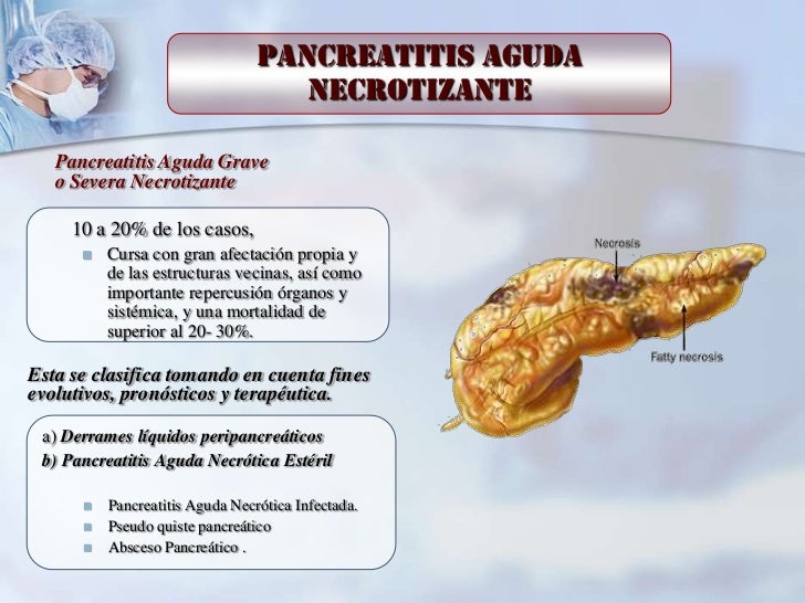 quiste pancreatico